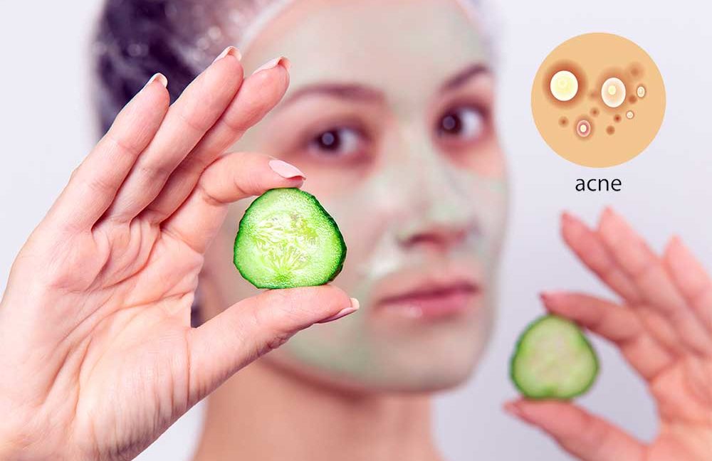 cucumber for acne treatment