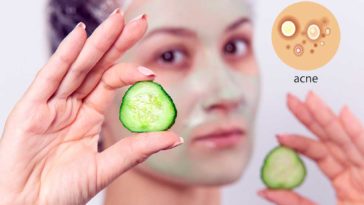 cucumber for acne treatment