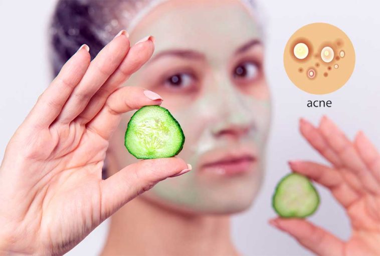 cucumber for acne treatment