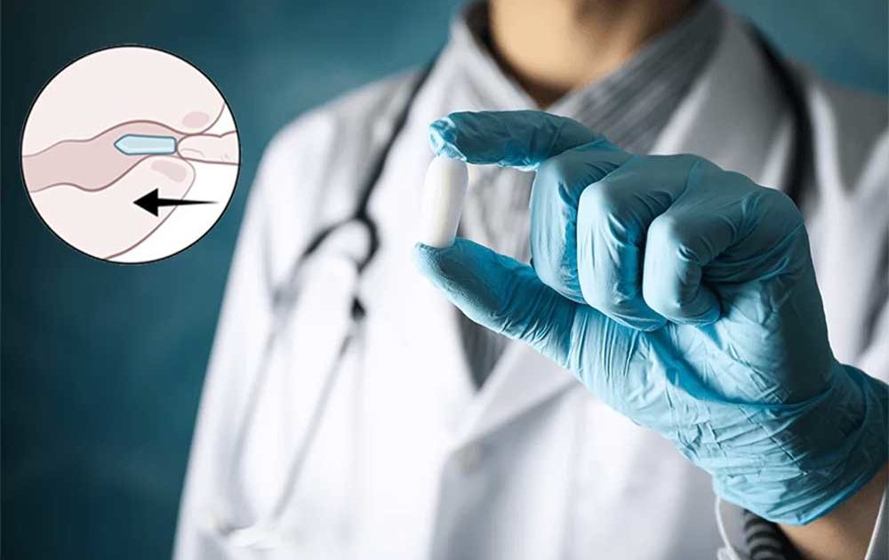 currect use of suppository medicine