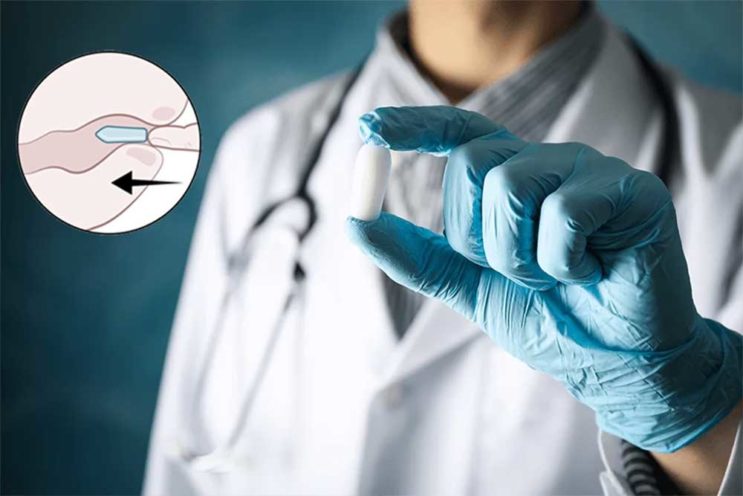 currect use of suppository medicine
