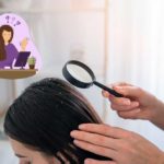 effective-home-remedies-to-treat-and-get-rid-of-dandruff