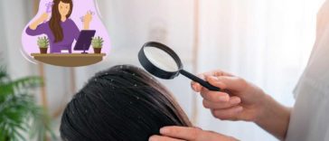 effective-home-remedies-to-treat-and-get-rid-of-dandruff