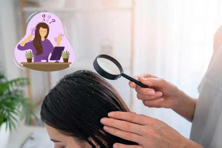 effective-home-remedies-to-treat-and-get-rid-of-dandruff