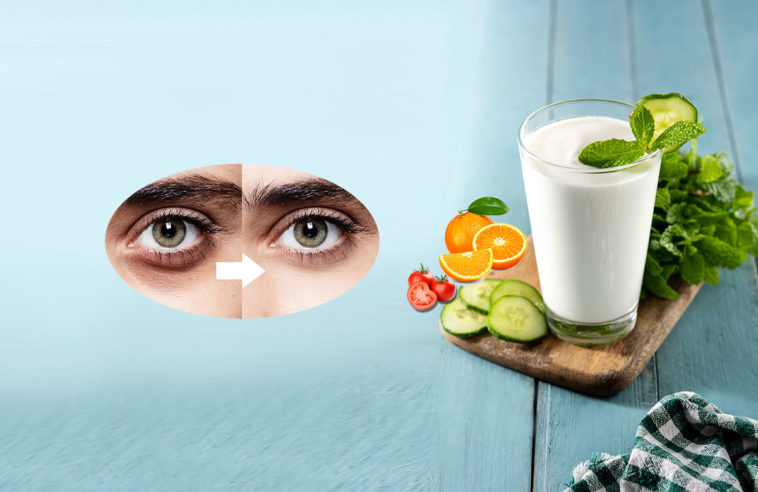 Natural way to remove dark circles under eyes