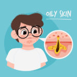 Oily-Skin-Care-in-Winter