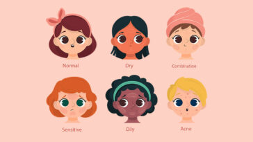 Different SKin Types