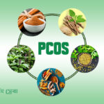 PCOS Natural Treatment