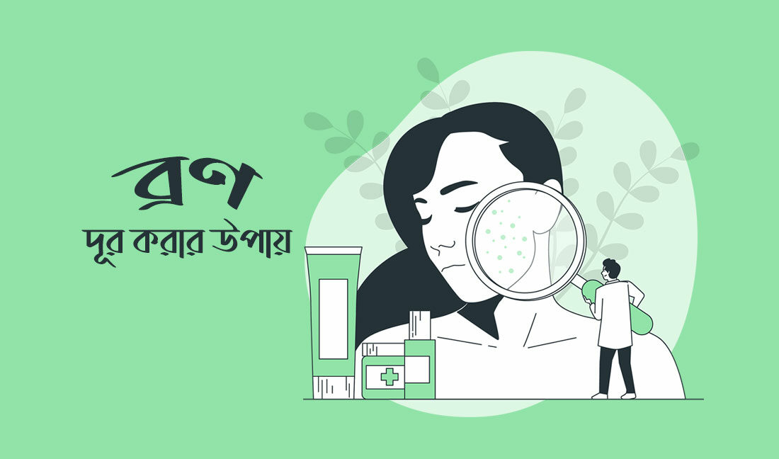 ব্রণ দূর করার উপায়