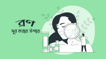 ব্রণ দূর করার উপায়