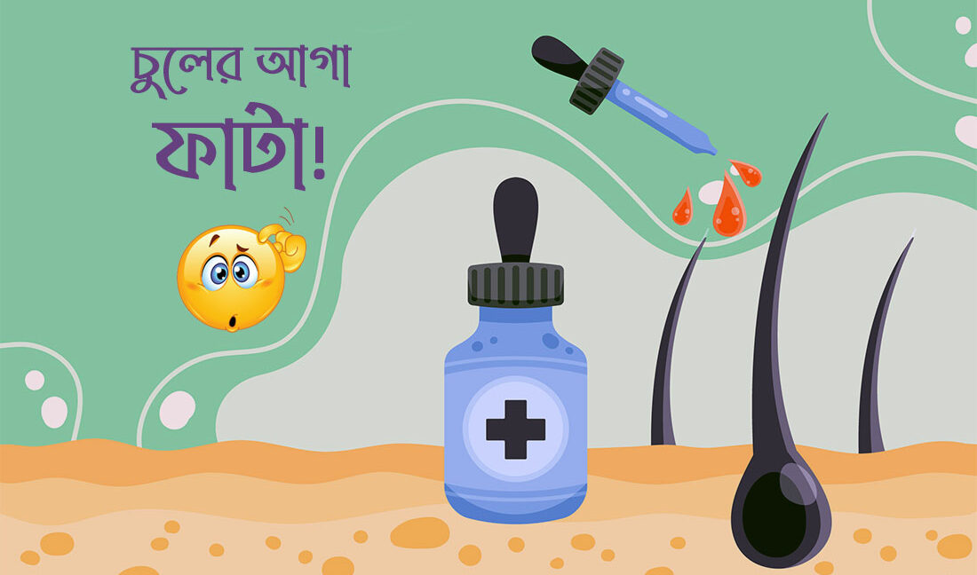 চুলের আগা ফাটা