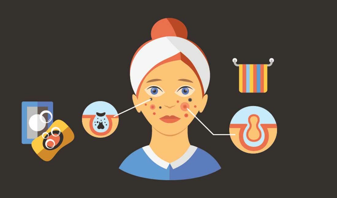 skin care for teenagers problems and solutions