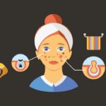 skin care for teenagers problems and solutions