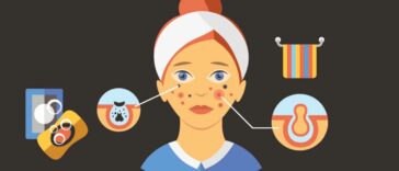 skin care for teenagers problems and solutions