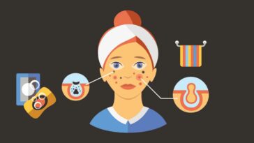 skin care for teenagers problems and solutions