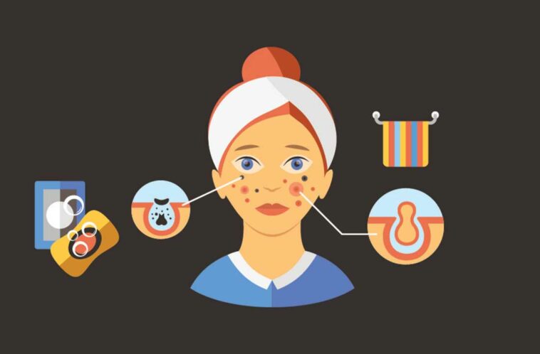 skin care for teenagers problems and solutions