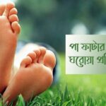 পা ফাটা রোধে ঘরোয়া প্রতিকার