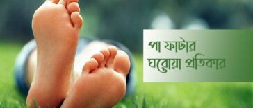 পা ফাটা রোধে ঘরোয়া প্রতিকার