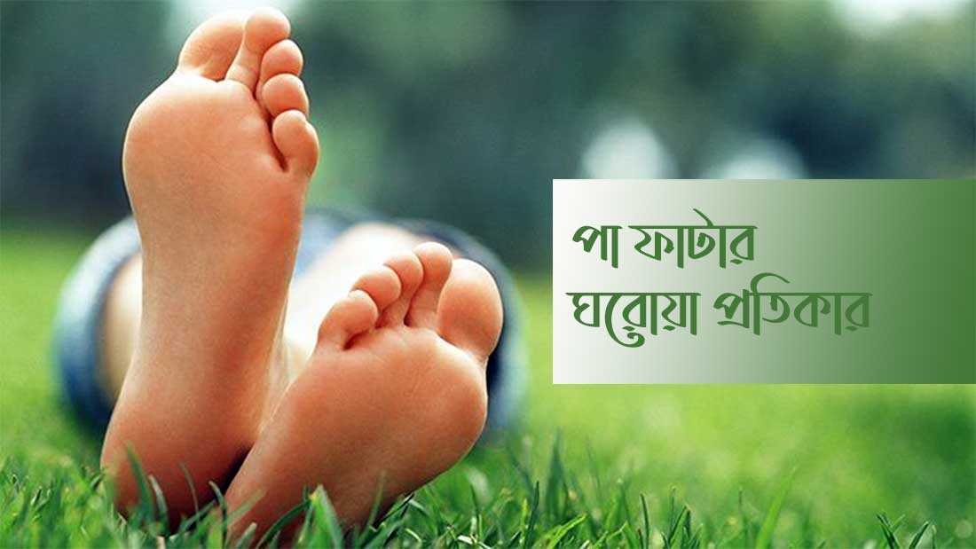 পা ফাটা রোধে ঘরোয়া প্রতিকার