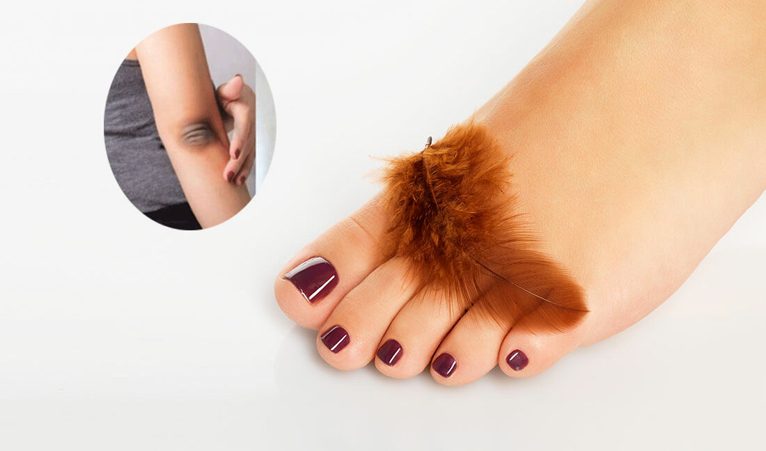 হাত পায়ের কালো দাগ