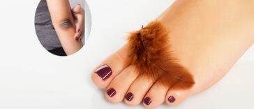 হাত পায়ের কালো দাগ